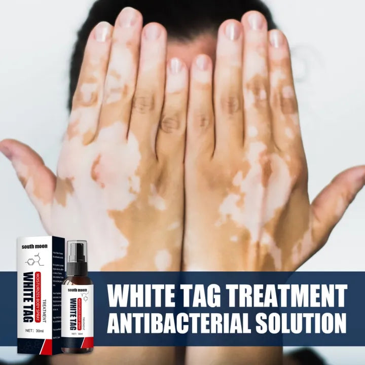 Spray hidratante original South Moon White Tag com óleo de mostarda para tratamento de vitiligo 30ml