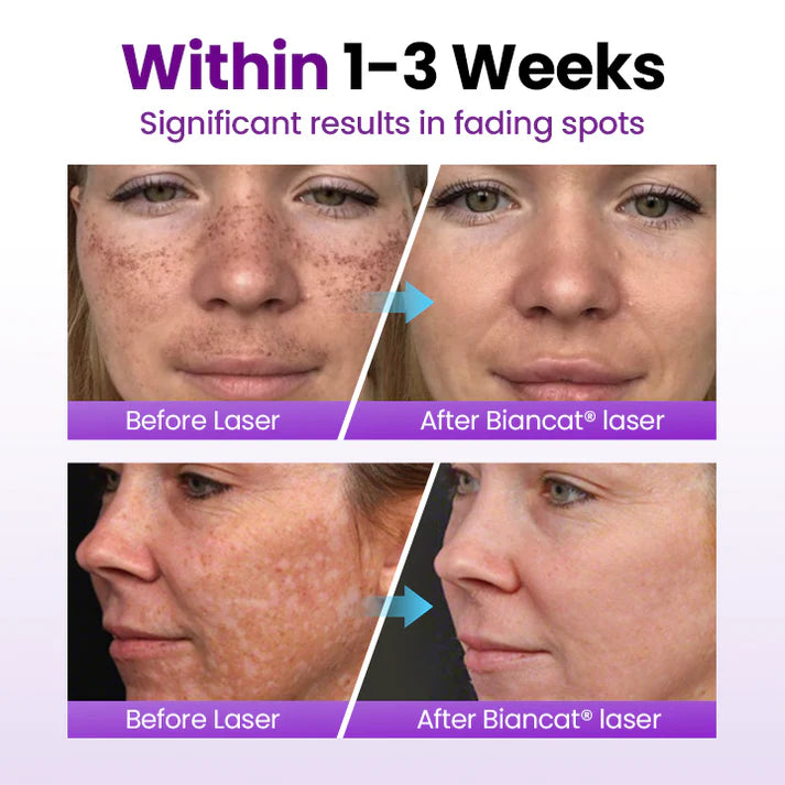 Sérum facial SpotErase com probióticos