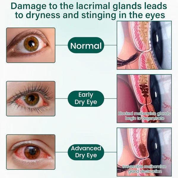 Sérum para olhos Ceoerty® OptiClear Nano em rolo