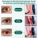 Sérum para olhos Ceoerty® OptiClear Nano em rolo