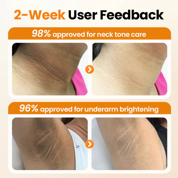 Creme Corporal Biancat® AHA GlowPurify