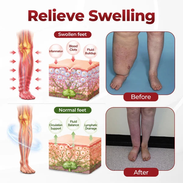 Creme para circulação sanguínea nas pernas Timilk® SwellVeil