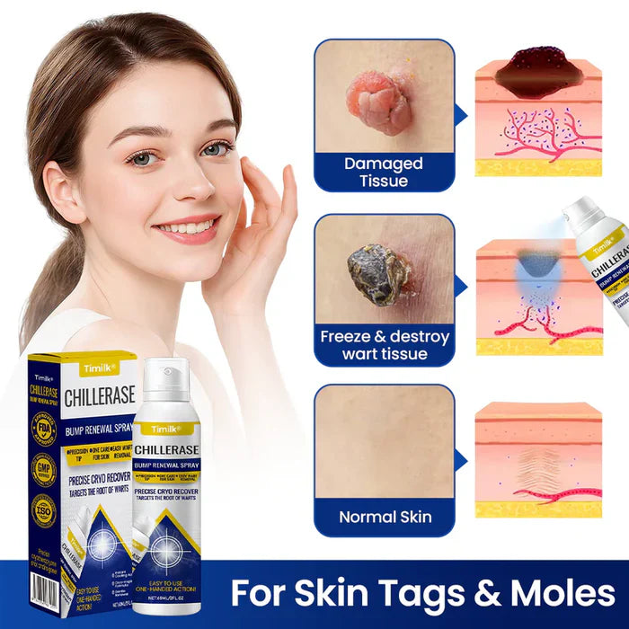 Spray renovador de protuberâncias Timilk® ChillErase