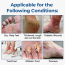 Bastão para tratamento de diabetes Ceoerty® PureFoot