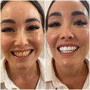 Caneta de gel clareadora dental Biancat® PearlWhite