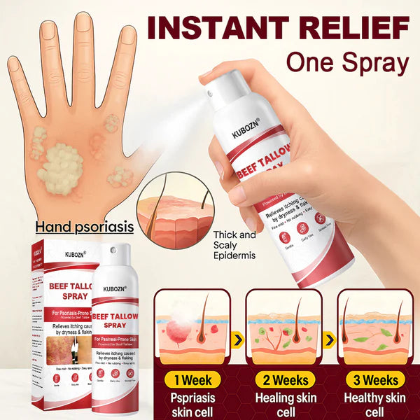 Spray de sebo bovino KUBOZN® para pele com psoríase que coça e descama.