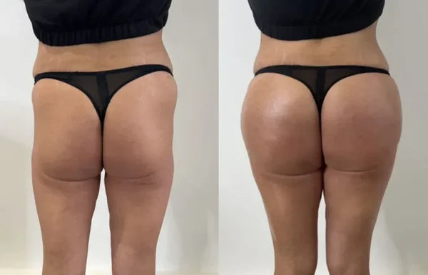 Creme para aumento dos seios e glúteos Luvora Biancat