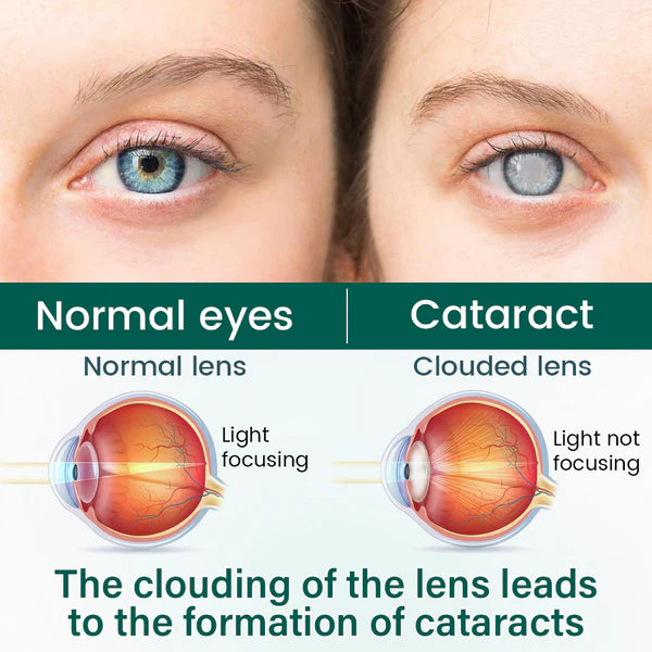 Sérum para olhos Ceoerty® OptiClear Nano em rolo