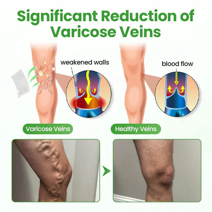 Adesivo de Microagulhas VeinHeal