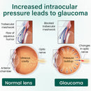 Sérum para olhos Ceoerty® OptiClear Nano em rolo