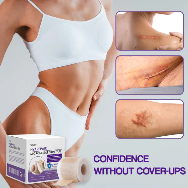 HyaRepair | Fita de Silicone para Rugas e Cicatrizes