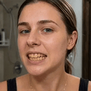 Caneta de gel clareadora dental Biancat® PearlWhite