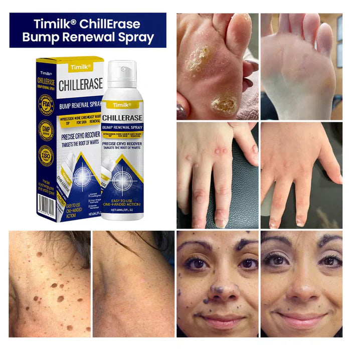 Spray renovador de protuberâncias Timilk® ChillErase