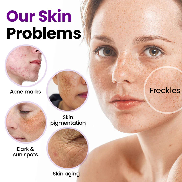 Sérum facial SpotErase com probióticos
