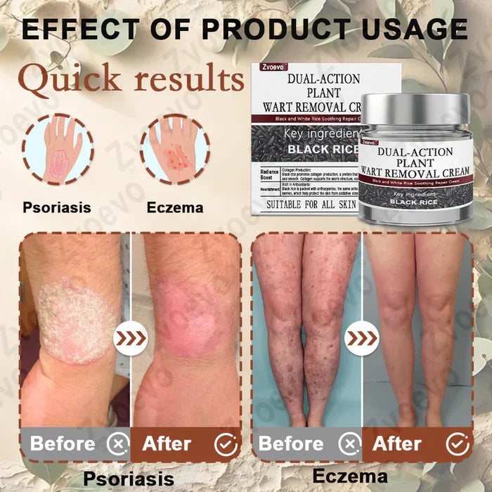 Black Rice Skin Repair Cream ⚕️ (Elimina verrugas e marcas, alivia psoríase, uniformiza a pele e reduz manchas)
