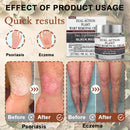 Black Rice Skin Repair Cream ⚕️ (Elimina verrugas e marcas, alivia psoríase, uniformiza a pele e reduz manchas)
