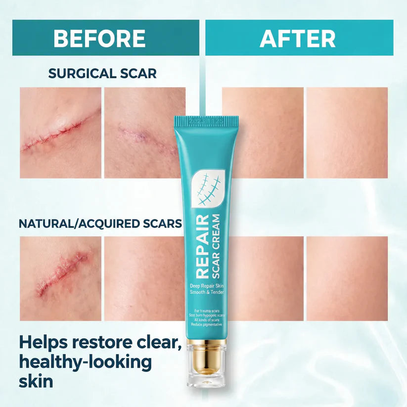 Deep Repair - Creme reparador de cicatrizes