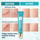 Deep Repair - Creme reparador de cicatrizes