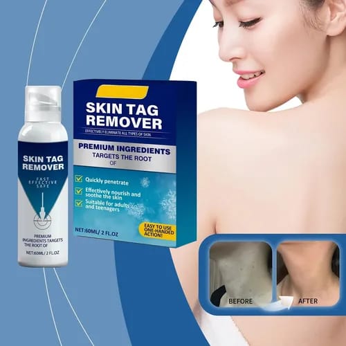 Spray de tratamento criogênico Fivfivgo® TagRecede
