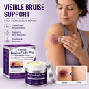Timilk® BruiseFade ProCreme para Eliminar Hematomas, Reduzir Manchas Roxas e Acelerar a Recuperação da Pele