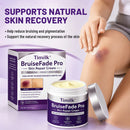 Timilk® BruiseFade ProCreme para Eliminar Hematomas, Reduzir Manchas Roxas e Acelerar a Recuperação da Pele