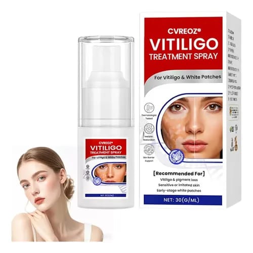 Spray para tratamento de vitiligo, removedor de manchas