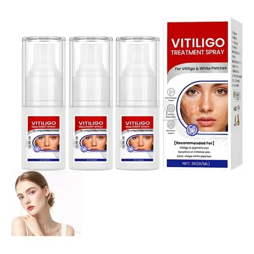 Spray para tratamento de vitiligo, removedor de manchas