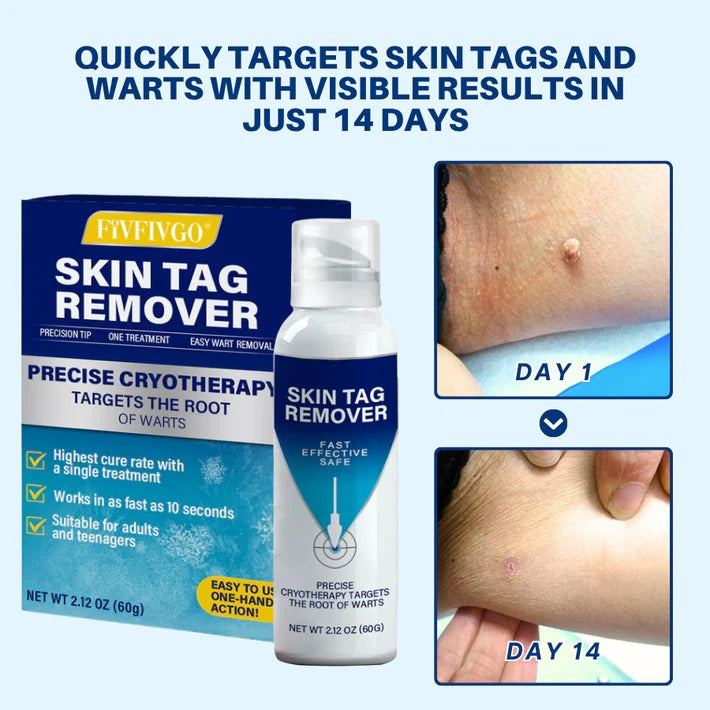 Spray de tratamento criogênico Fivfivgo® TagRecede
