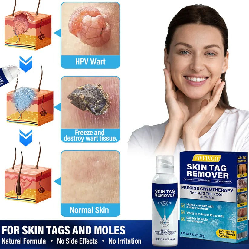 Spray de tratamento criogênico Fivfivgo® TagRecede